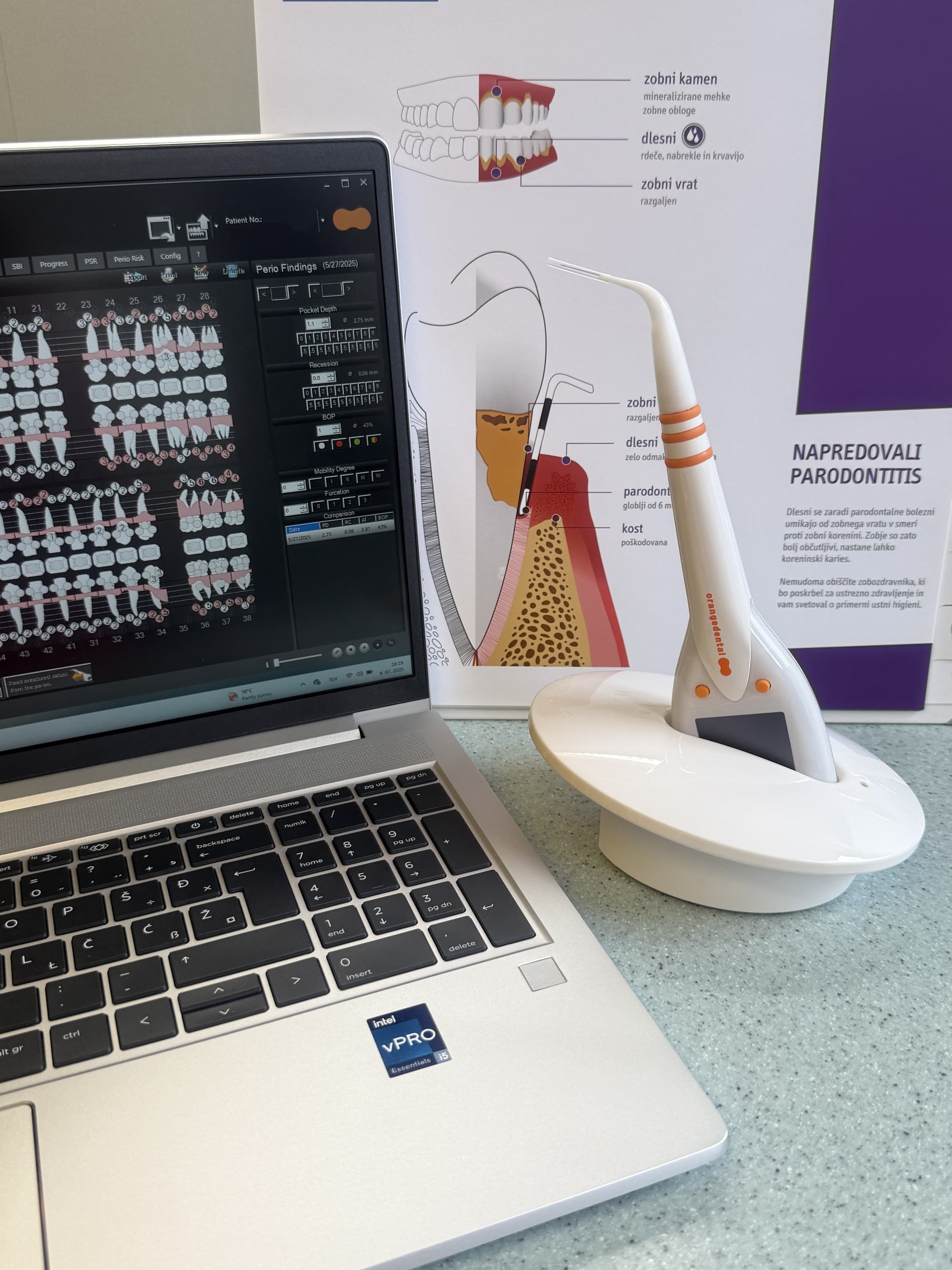 Zapis parodontalnega stanja